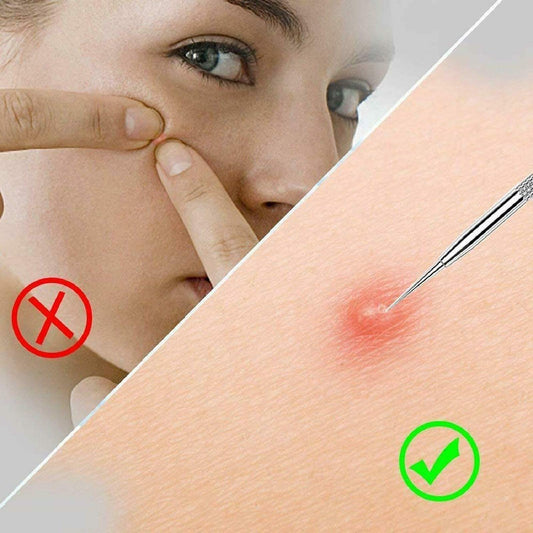 4PCS Blackhead removal tool kit. Four-piece with storage box for nose facial care silver